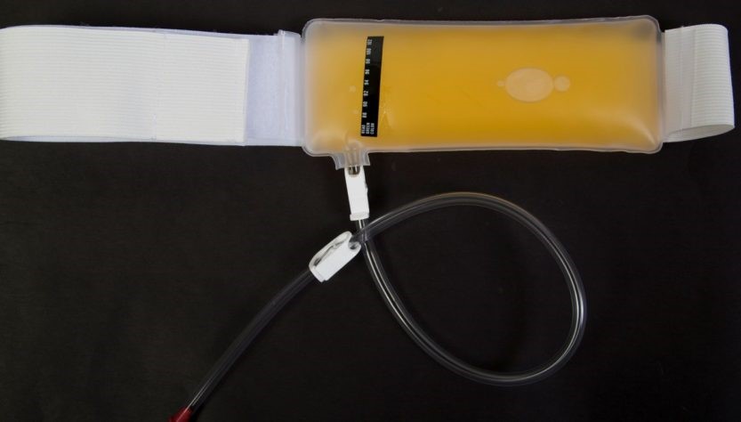 Synthetic Urine Detection Walker WV 26180